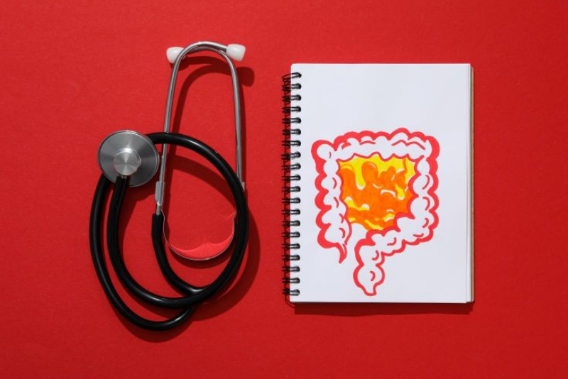 30-10_Cannabis-na-Doença-de-Crohn-da-ausência-de-resposta-à-remissão-clínica-e-estrutural